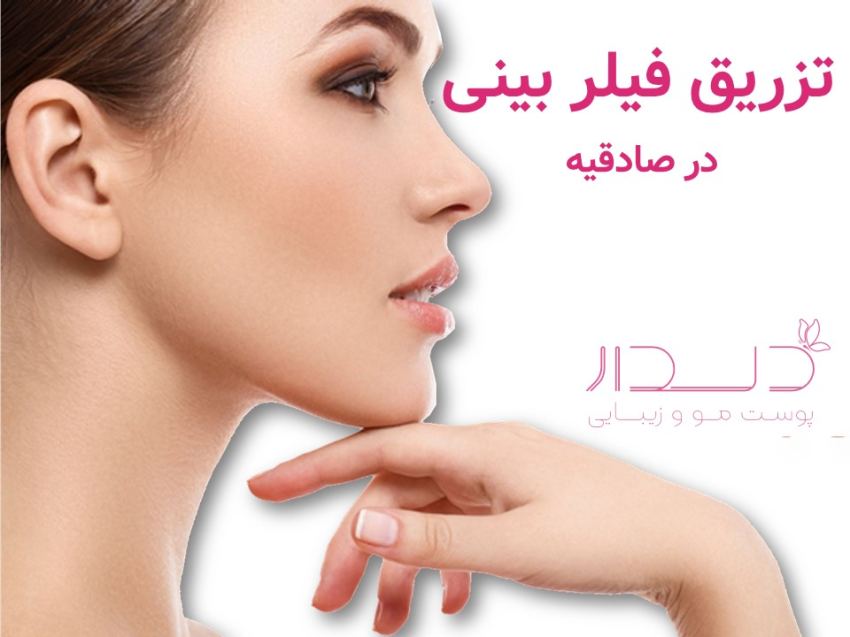 فیلر بینی