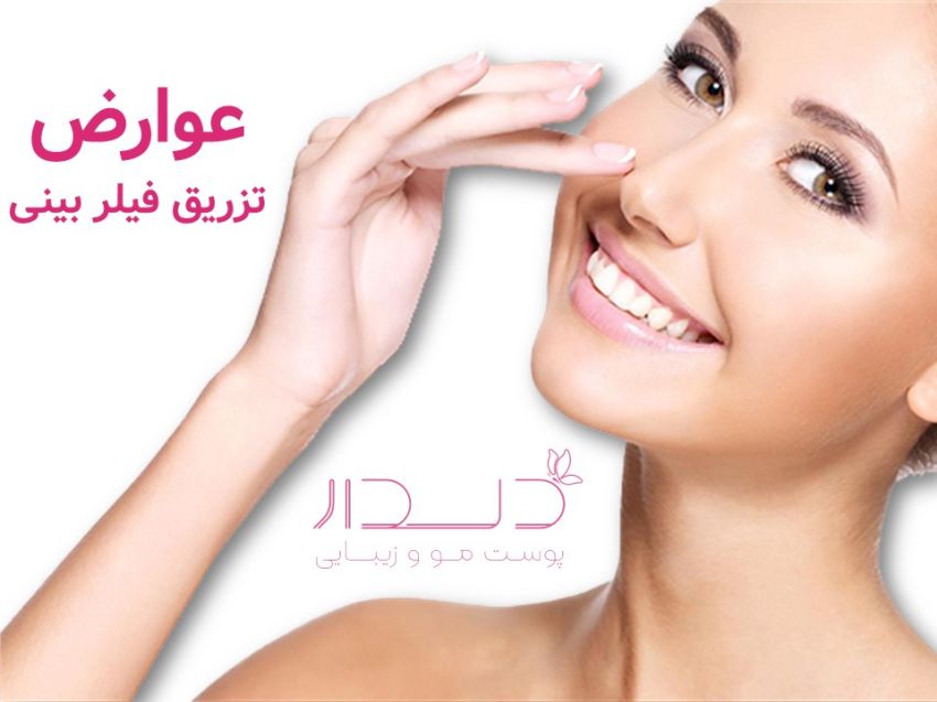 عوارض فیلر بینی