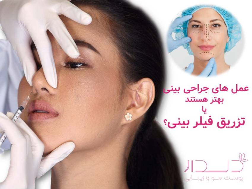 عمل بینی یا فیلر بینی