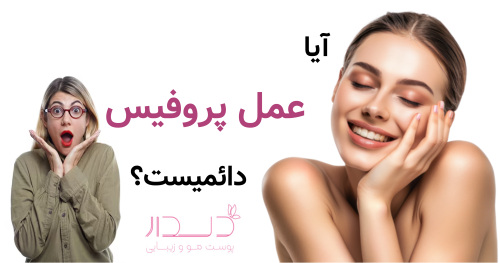 آیا عمل پروفیس دائمیست؟