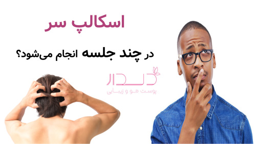 اسکالپ سر در چند جلسه انجام می‌شود؟