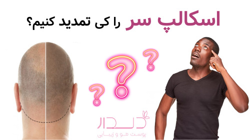 اسکالپ سر را کی تمدید کنیم؟