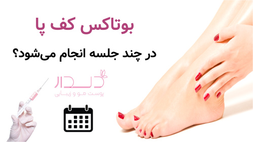 بوتاکس کف پا در چند جلسه انجام می‌شود و چقدر ماندگار است؟