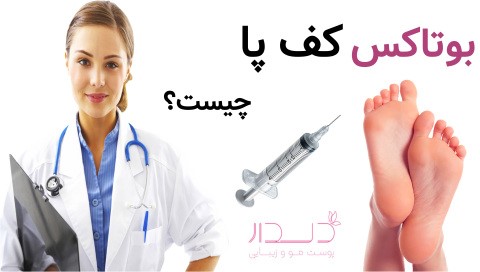بوتاکس کف پا چیست؟