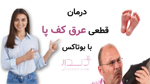 درمان عرق کف پا با بوتاکس
