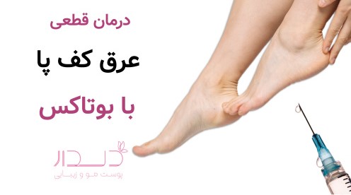 درمان قطعی عرق کف پا با بوتاکس