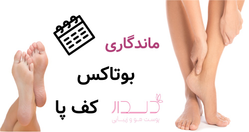 ماندگاری بوتاکس کف پا