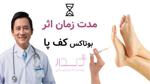 مدت زمان اثر بوتاکس کف پا