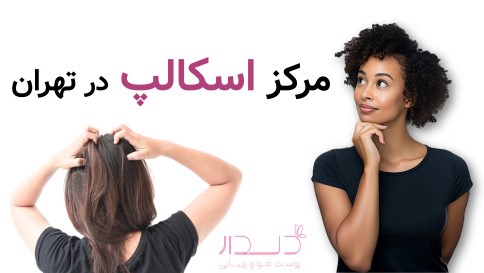 مرکز اسکالپ در تهران