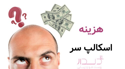 هزینه اسکالپ سر چقدر است؟