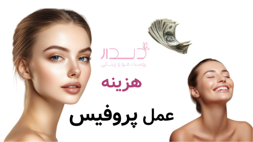 هزینه عمل پروفیس