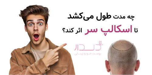 چه مدت طول می‌کشد تا اسکالپ سر اثر کند؟