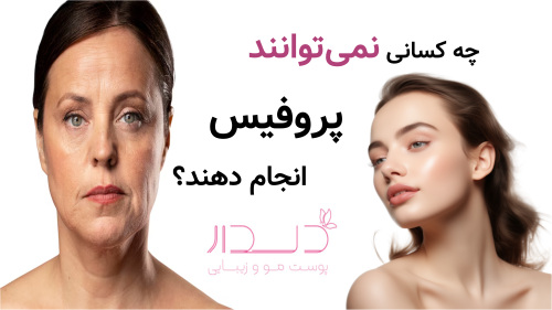 چه کسانی نمی‌توانند پروفیس انجام دهند؟