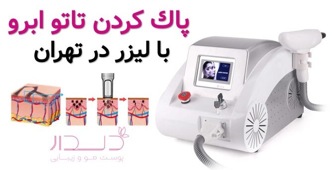 بهترین مرکز ریموو تتو در تهران
