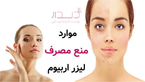 موارد منع مصرف لیزر اربیوم
