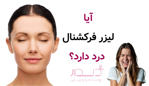 آیا لیزر فرکشنال درد دارد؟