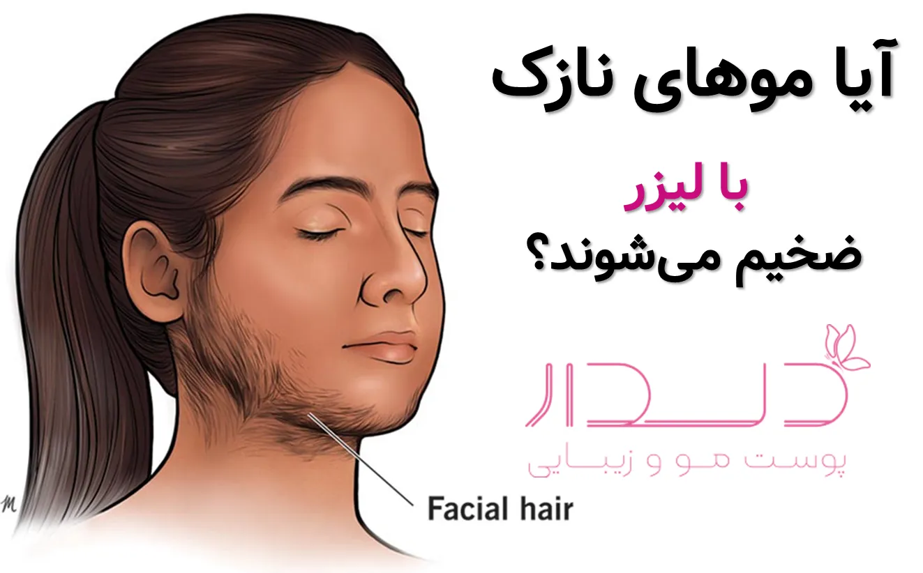 بهترین دستگاه لیزر برای موهای نازک