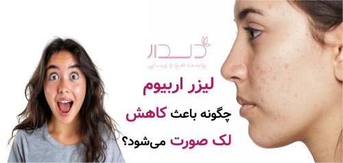 لیزر اربیوم چگونه باعث کاهش لک صورت می‌شود؟