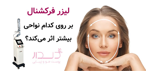 لیزر فرکشنال بر روی کدام نواحی بیشتر اثر می‌کند؟