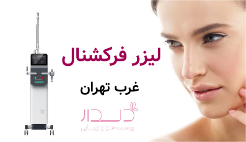 لیزر فرکشنال در غرب تهران