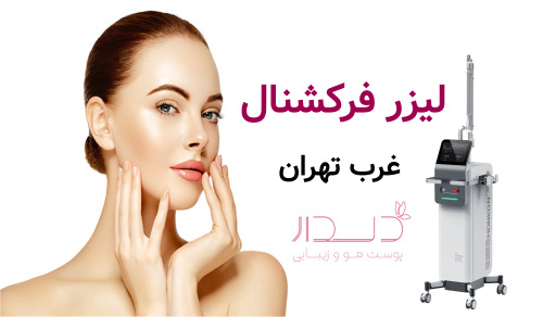 لیزر فرکشنال غرب تهران