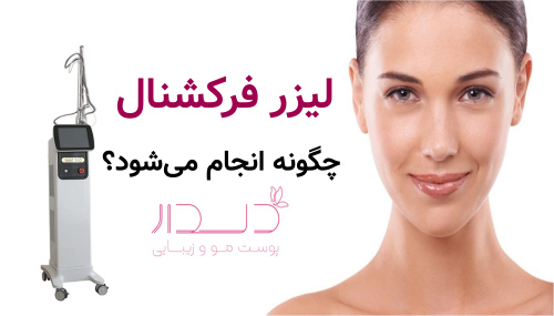 لیزر فرکشنال چگونه انجام می‌شود؟