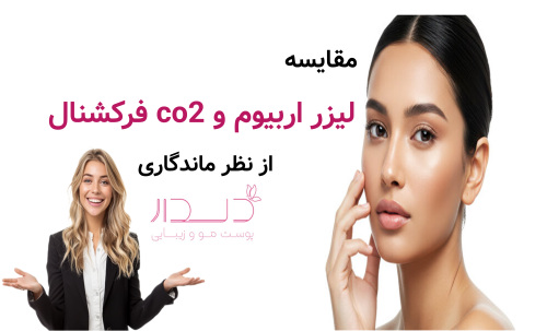 مقایسه لیزر اربیوم و co2 فرکشنال از نظر ماندگاری