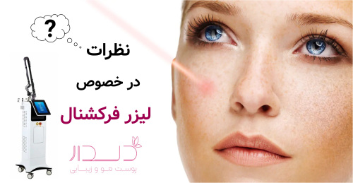 نظرات در خصوص لیزر فرکشنال