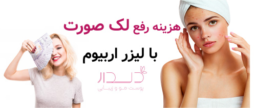 هزینه رفع لک صورت با لیزر اربیوم