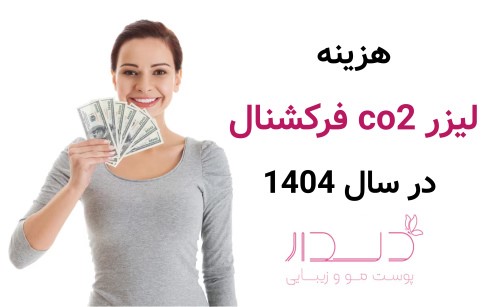هزینه لیزر co2 فرکشنال در سال 1404