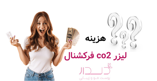 هزینه لیزر co2 فرکشنال