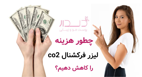 چطور هزینه لیزر فرکشنال co2 را کاهش دهیم؟