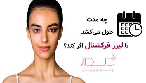چه مدت طول می‌کشد تا لیزر فرکشنال اثر کند؟
