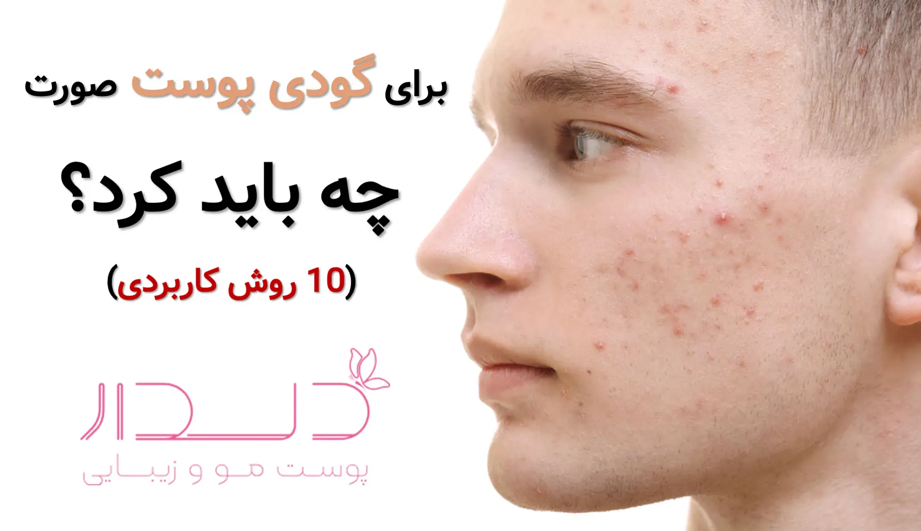 برای گودی پوست صورت چه باید کرد؟/10 روش کاربردی