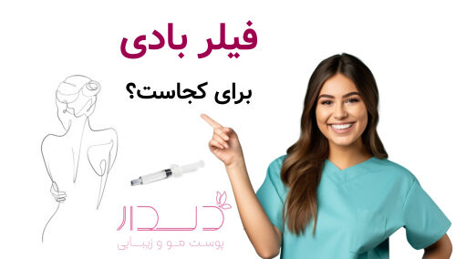 فیلر بادی برای کجاست؟