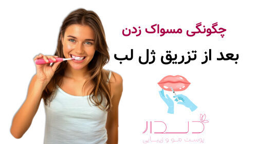 چگونگی مسواک زدن بعد از تزریق ژل لب