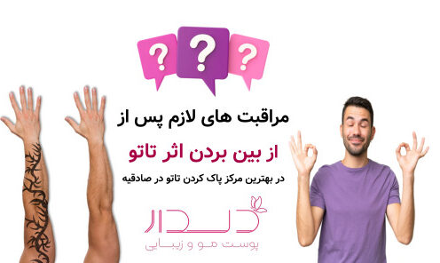 مراقبت های لازم پس از از بین بردن اثر تاتو در بهترین مرکز پاک کردن تاتو در صادقیه