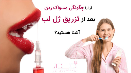 آیا با چگونگی مسواک زدن بعد از تزریق ژل لب آشنا هستید؟