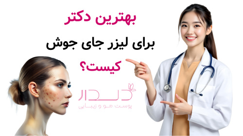بهترین دکتر برای لیزر جای کیست؟