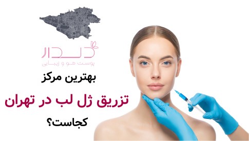بهترین مرکز تزریق ژل لب در تهران کجاست؟