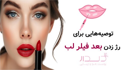 توصیه‌هایی برای رژ زدن بعد فیلر لب