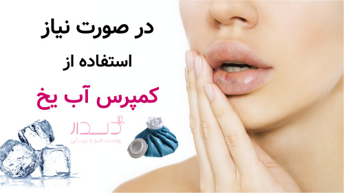 در صورت نیاز استفاده از کمپرس آب یخ