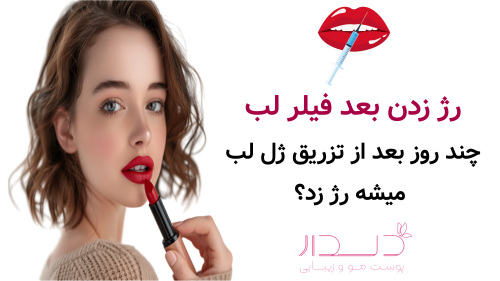 رژ زدن بعد فیلر لب چند روز بعد از تزریق ژل لب میشه رژ زد 