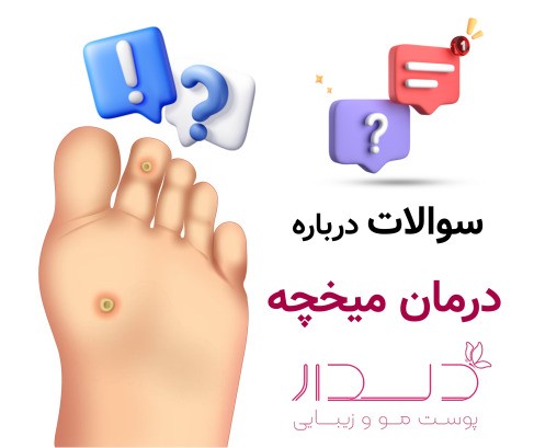 سوالات درباره درمان میخچه