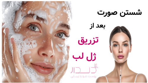 شستن صورت بعد از تزریق ژل لب ممنوع است!