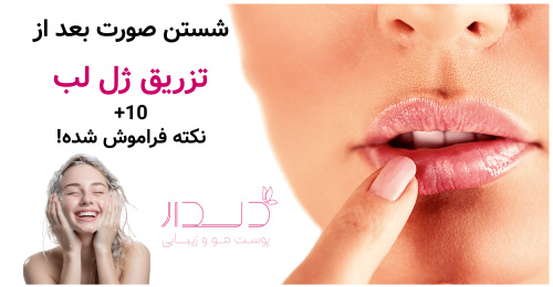 شستن صورت بعد از تزریق ژل لب+10 نکته فراموش شده!