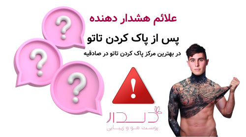 علائم هشدار دهنده پس از پاک کردن تاتو در بهترین مرکز پاک کردن تاتو در صادقیه