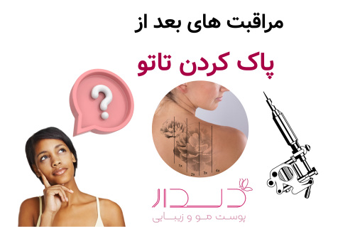 مراقبت های بعد از پاک کردن تاتو