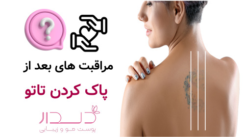 مراقبت های بعد پاک کردن تاتو