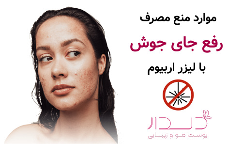 موارد منع مصرف رفع جای جوش با لیزر اربیوم